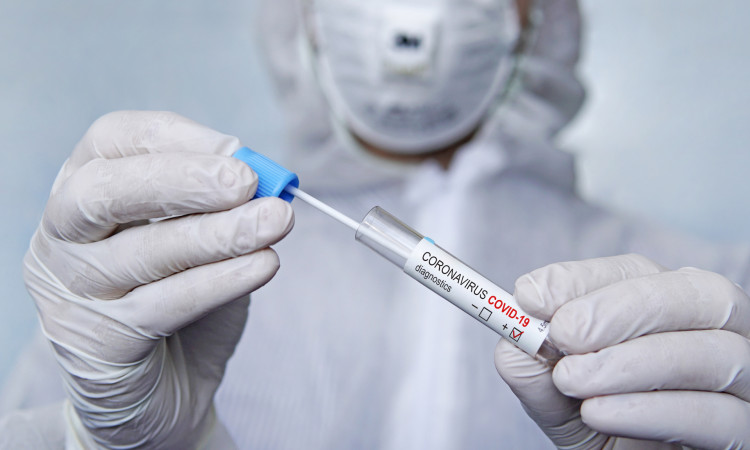 Wykonaj test na obecność wirusa SARS-CoV-2 metodą real time PCR – szybko, bezpiecznie  i wygodnie - bez skierowania od lekarza ubezpieczenia zdrowotnego