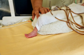 Nowy standard w kardiologii interwencyjnej u wcześniaków – pierwszy zabieg zamknięcia przewodu tętniczego (PDA) wyłącznie pod kontrolą USG w IPCZD